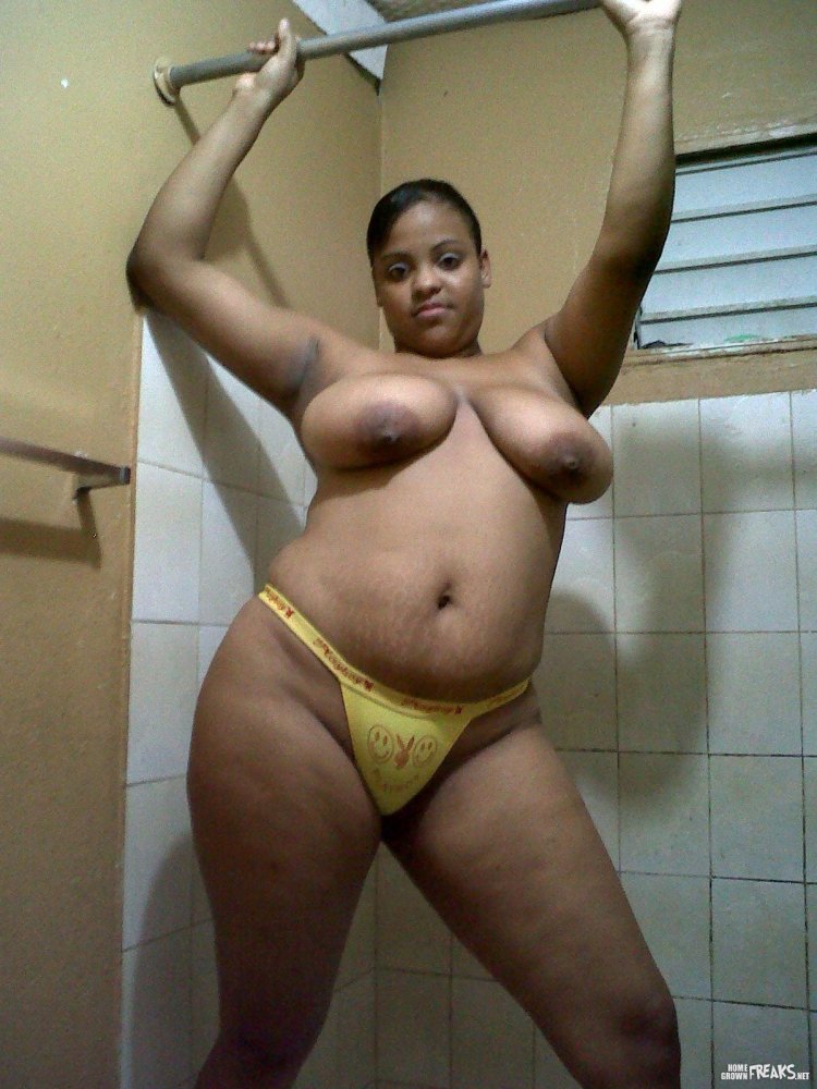 Polest -burned black women