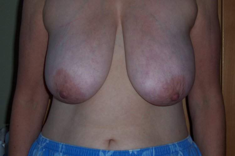 Porn actresses Saggy Tit Small Sex