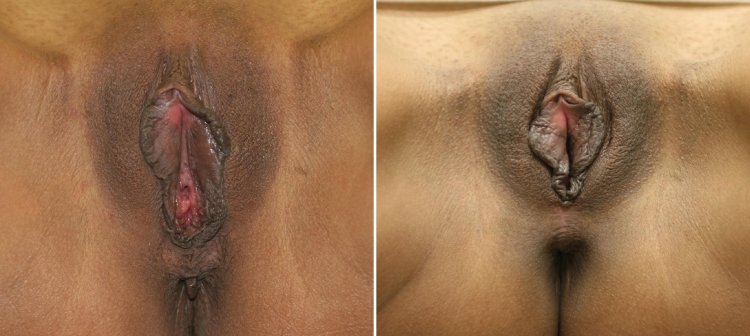 Melissa Mendini Vagina