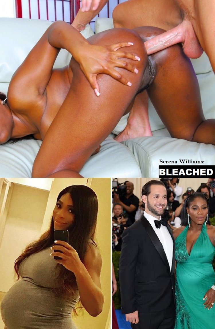 Serena Williams was exposed