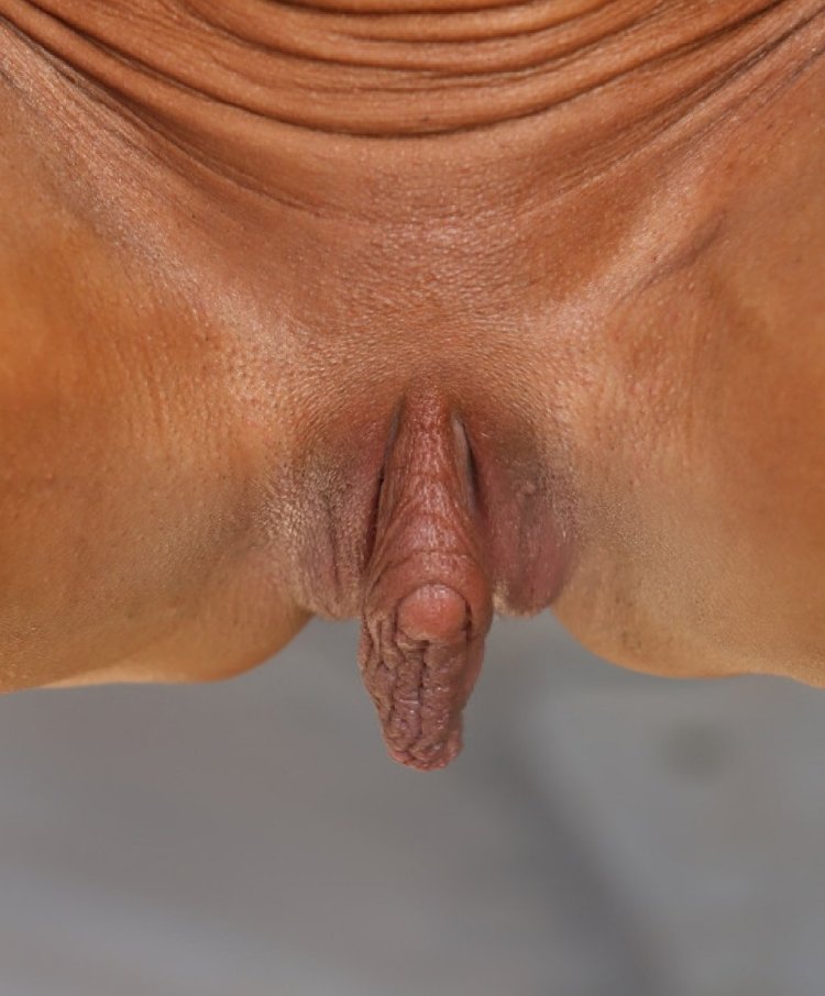 Girls with a large clitoris