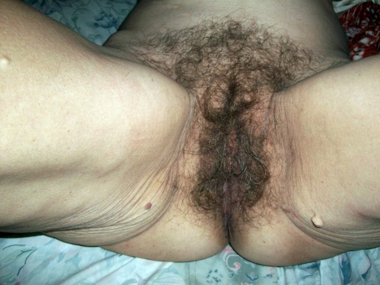 Old vulva on the stomach