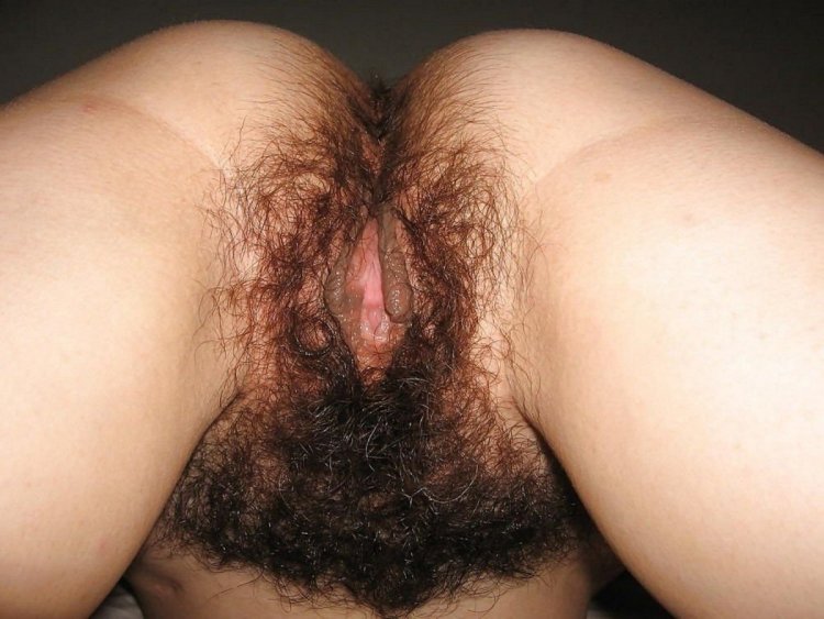 Strongly hairy vagina