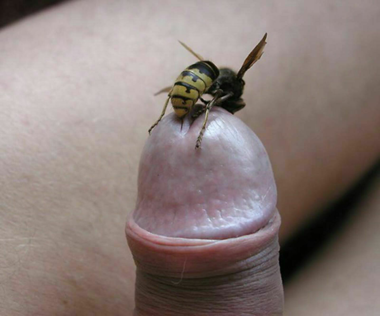The bee stung in the penis