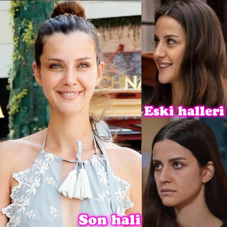 Irem Helvajioglu plastic