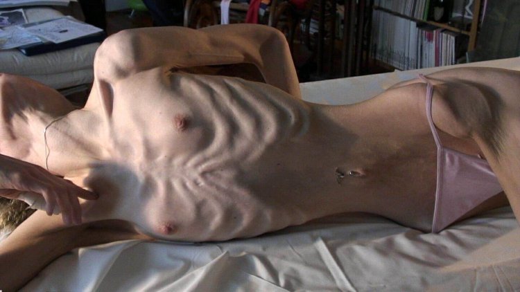 Naked skinny anorexics