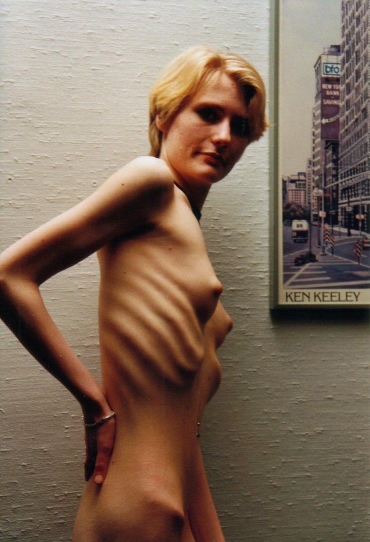 Naked anorexic model