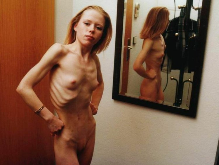 Naked anorexic girls