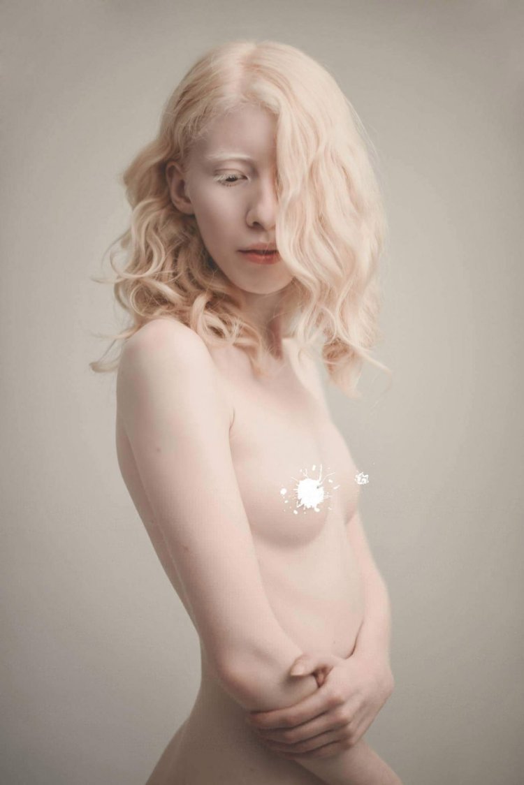 The girl Albino is naked