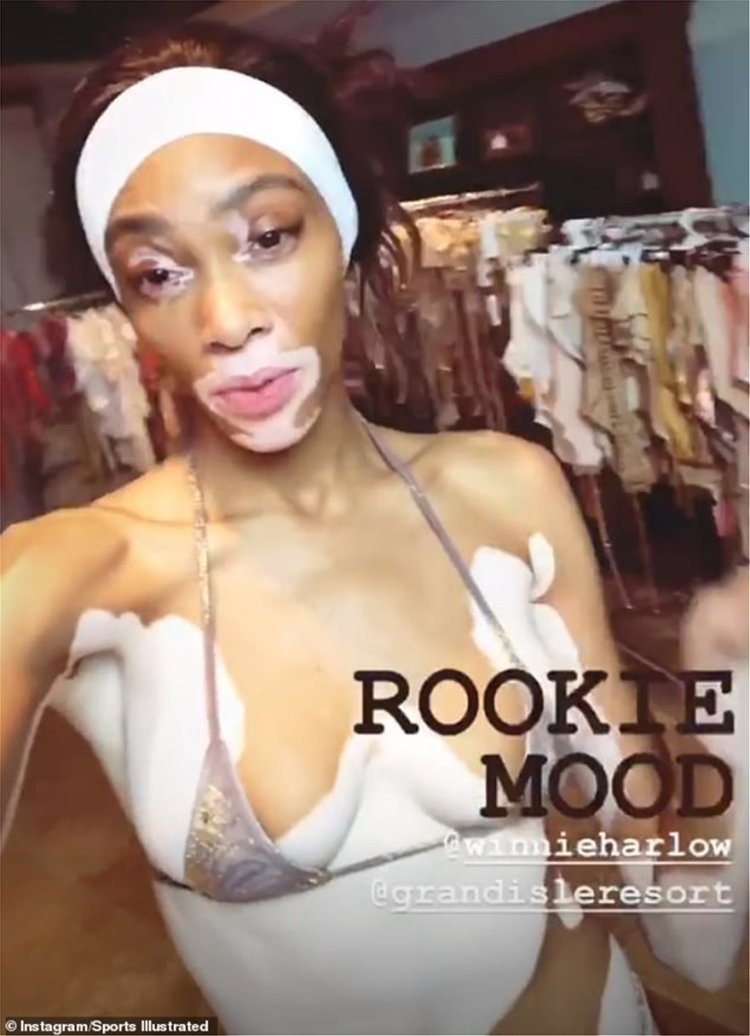 Winnie Harlow Playboy