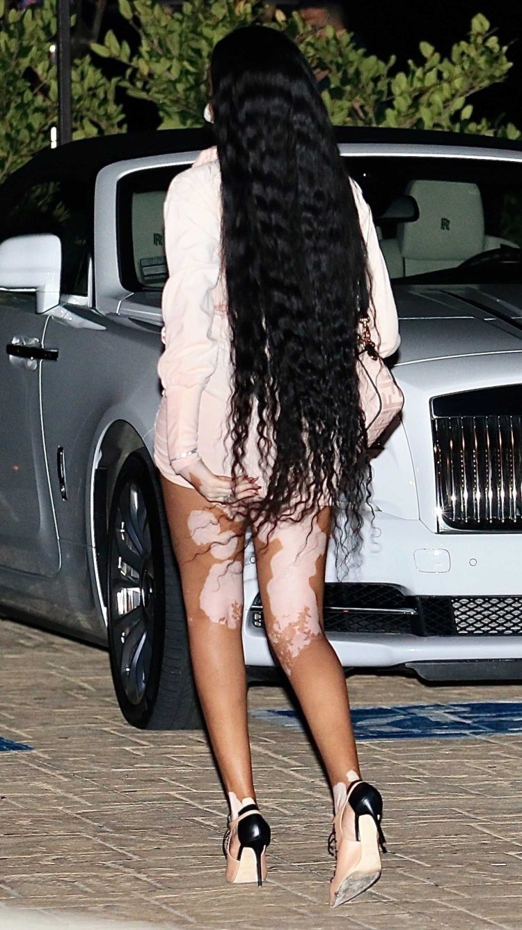 Model with Vitiligo Winnie Harlow
