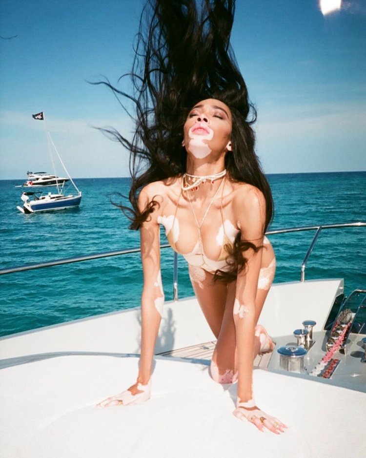 Winnie Harlow and Kendall