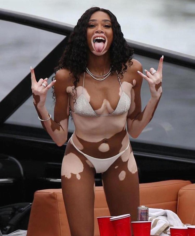 Winnie Harlow Message-