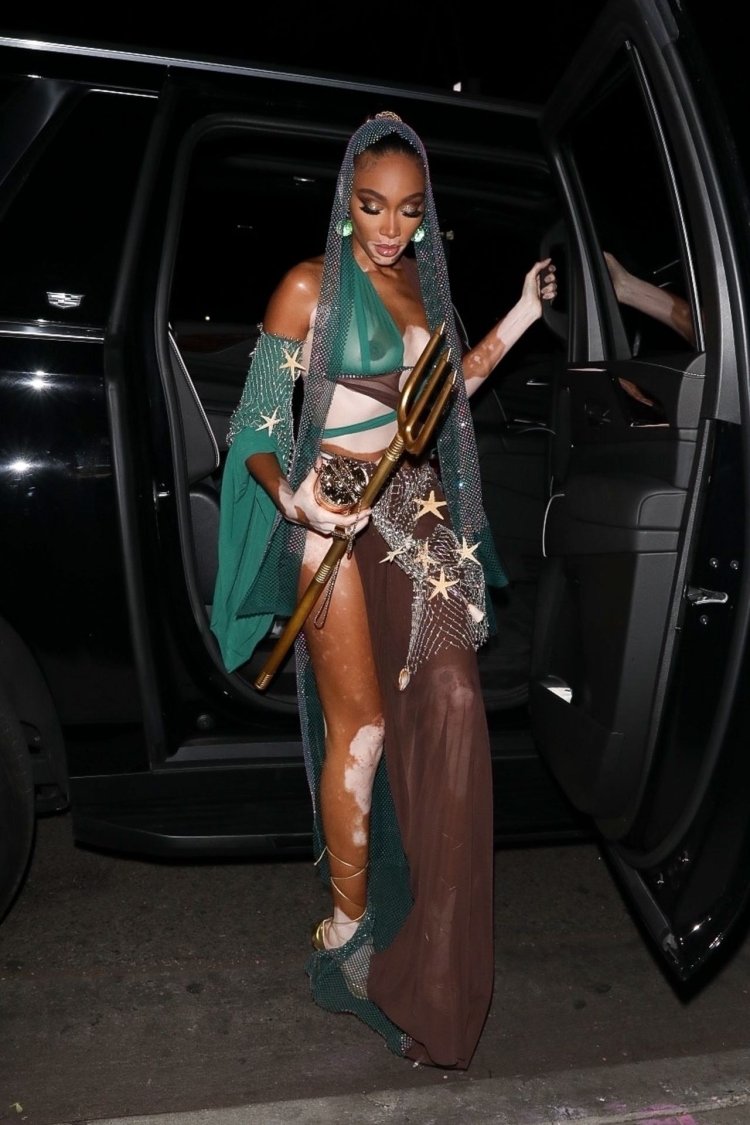 Model with vitiligo naked