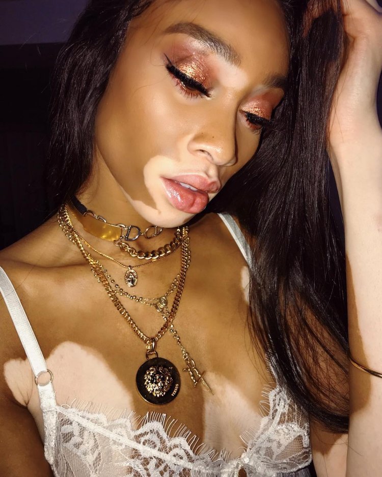 Winnie Harlow Naked Tits