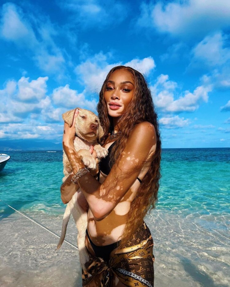 Winnie Harlow Met Gala 2021