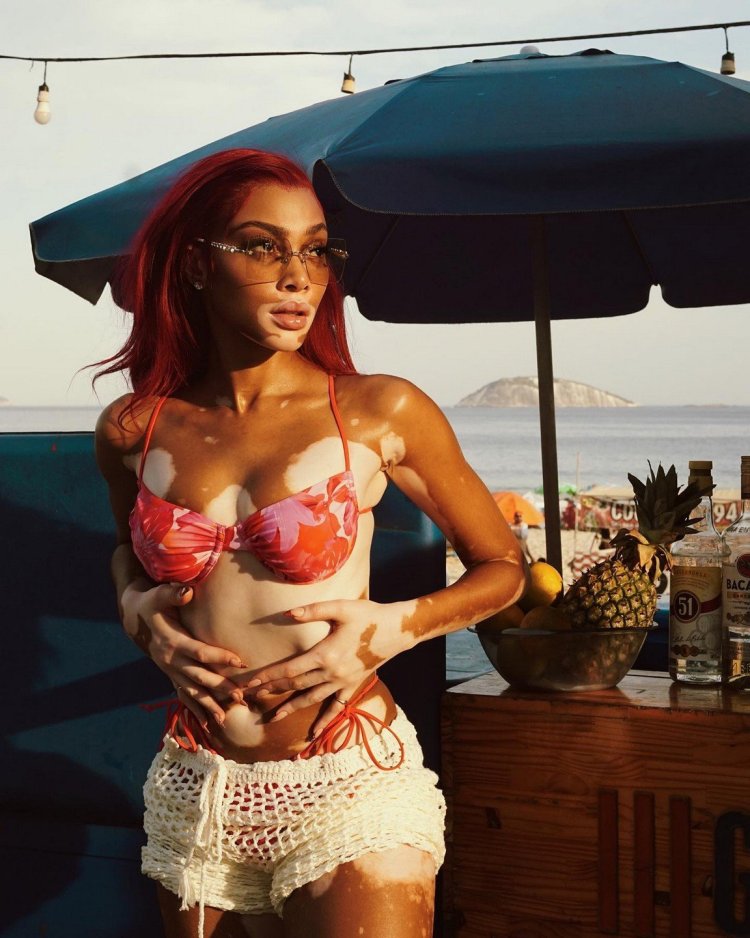 Winnie Harlow is naked