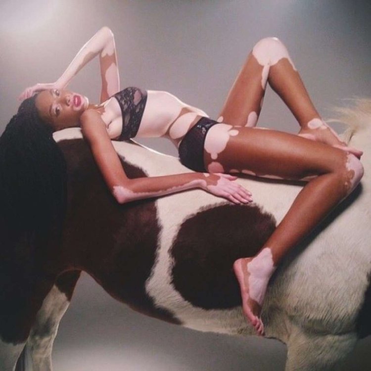 Winnie Harlow Naked Tits