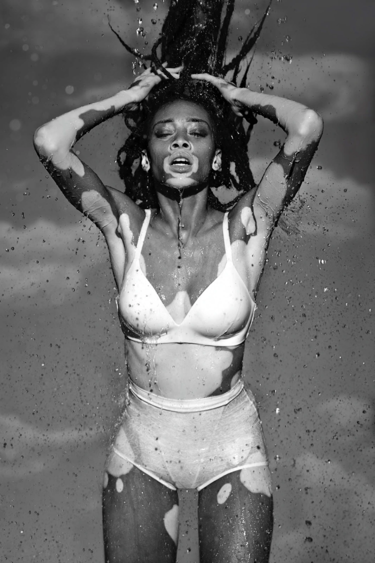 Winnie Harlow photo nude
