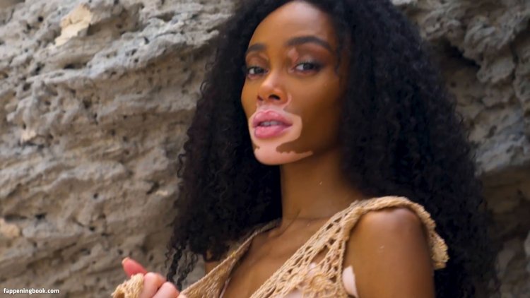 Winnie Harlow