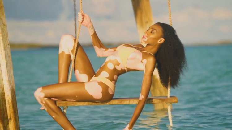 Winnie Harlow Met Gala 2022