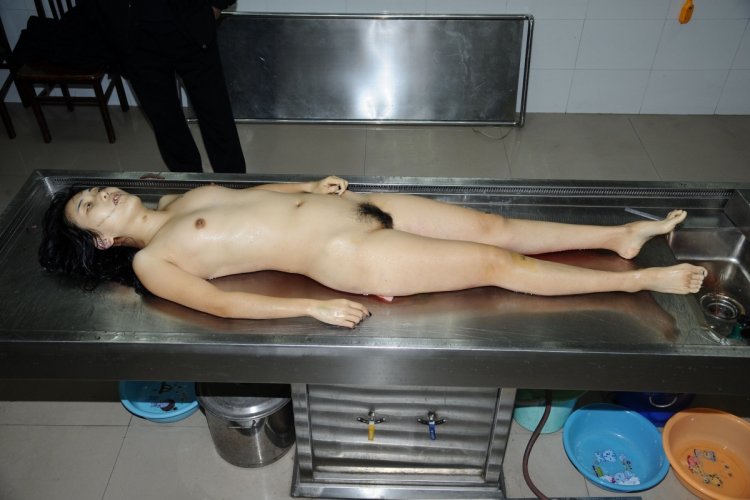 Silicone boobs in the morgue