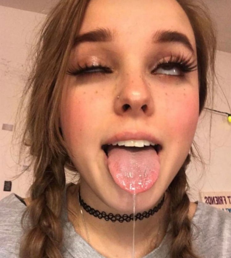 Face in saliva of a teenager girl